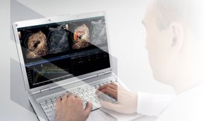 Quantification Software Revolutionizing Data Analysis