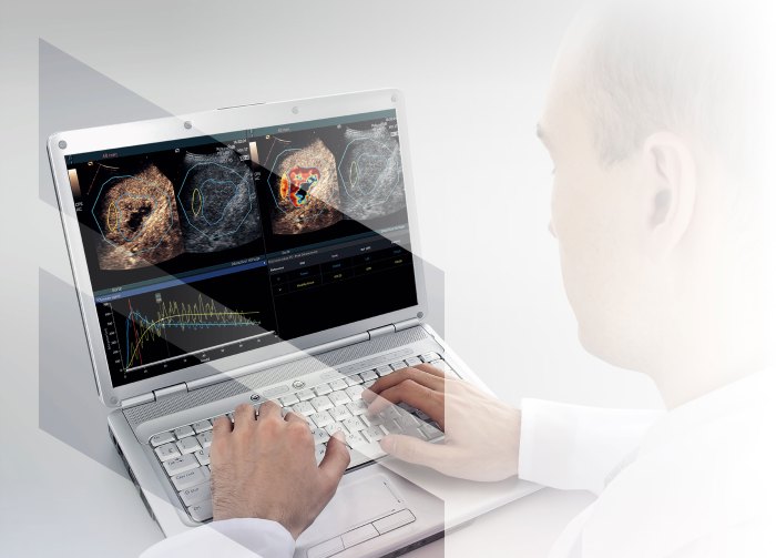 Quantification Software Revolutionizing Data Analysis