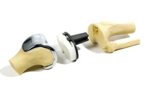 knee replacement hardware Revolutionizing Mobility Solutions